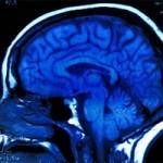 Исследователь из Германии отыскал в мозге человека «зону зла»